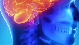 Bachelor-Studiengang Medizinische Radiologietechnologie